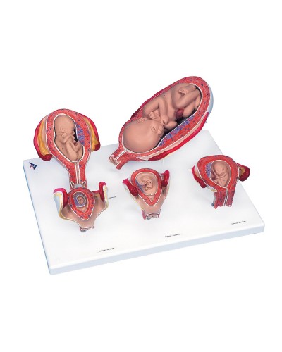 3B Scientific® Pregnancy Series - 5 Models